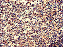 Immunohistochemistry analysis of human tonsil tissue using CSB-PA011113LA01HU at dilution of 1:100