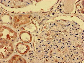 Immunohistochemistry analysis of human kidney tissue using CSB-PA011113LA01HU at dilution of 1:100