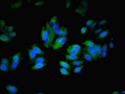 Immunofluorescence(IF) - ITGAL Antibody