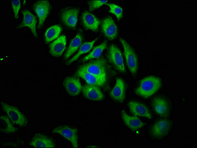 Immunofluorescence(IF) - ITGB6 Antibody