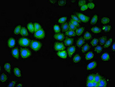 Immunofluorescent analysis of A549 cells using CSB-PA012824YA01HU at dilution of 1:100 and Alexa Fluor 488-congugated AffiniPure Goat Anti-Rabbit IgG(H+L)