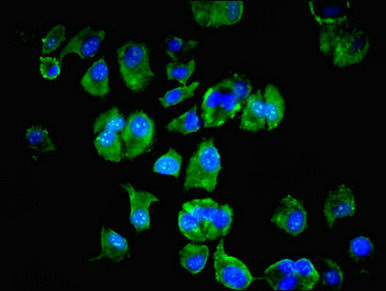 Immunofluorescent analysis of MCF-7 cells using CSB-PA013207HA01HU at dilution of 1:100 and Alexa Fluor 488-congugated AffiniPure Goat Anti-Rabbit IgG(H+L)
