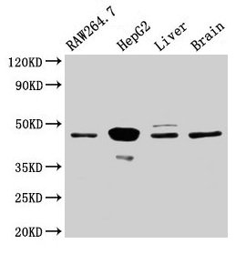 Western Blot Positive WB detected in: RAW264.7 whole cell lysate, HepG2 whole cell lysate, Rat liver tissue, Mouse brain tissue All lanes: Map2k4 antibody at 3.2microg/ml Secondary Goat polyclonal to rabbit IgG at 1/50000 dilution Predicted band size: 45 kDa Observed band size: 45 kDa