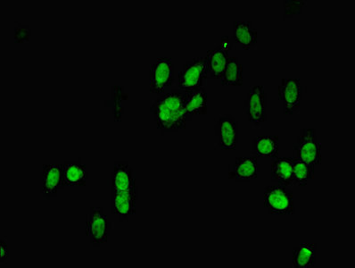 Immunofluorescent analysis of Hela cells using CSB-PA013465ESR1HU at dilution of 1:100 and Alexa Fluor 488-congugated AffiniPure Goat Anti-Rabbit IgG(H+L)
