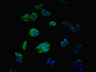 Immunofluorescent analysis of HepG2 cells using CSB-PA013522ESR1HU at dilution of 1:100 and Alexa Fluor 488-congugated AffiniPure Goat Anti-Rabbit IgG(H+L)