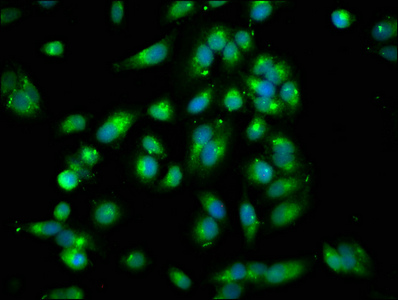 Immunofluorescence staining of Hela cells with CSB-PA01445A0Rb at 1:250, counter-stained with DAPI. The cells were fixed in 4% formaldehyde, permeabilized using 0.2% Triton X-100 and blocked in 10% normal Goat Serum. The cells were then incubated with the antibody overnight at 4°C. The secondary antibody was Alexa Fluor 488-congugated AffiniPure Goat Anti-Rabbit IgG(H+L).
