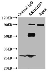 Immunoprecipitating ARHGEF7 in Hela whole cell lysate Lane 1: Rabbit control IgG (1microg) instead of CSB-PA01445A0Rb in Hela whole cell lysate. For western blotting, a HRP-conjugated Protein G antibody was used as the secondary antibody (1/2000) Lane 2: CSB-PA01445A0Rb (6microg) + Hela whole cell lysate (500microg) Lane 3: Hela whole cell lysate (10microg) Immunoprecipitating ARHGEF7 in Hela whole cell lysate Lane 1: Rabbit control IgG (1microg) instead of CSB-PA01445A0Rb in Hela whole cell lysate. For western blotting, a HRP-conjugated Protein G antibody was used as the secondary antibody (1/2000) Lane 2: CSB-PA01445A0Rb (6microg) + Hela whole cell lysate (500microg) Lane 3: Hela whole cell lysate (10microg)