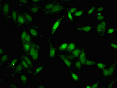 Immunofluorescent analysis of Hela cells using CSB-PA01469A0Rb at dilution of 1:100 and Alexa Fluor 488-congugated AffiniPure Goat Anti-Rabbit IgG(H+L)