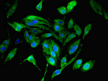 Immunofluorescent analysis of Hela cells using CSB-PA014826EA01HU at dilution of 1:100 and Alexa Fluor 488-congugated AffiniPure Goat Anti-Rabbit IgG(H+L)