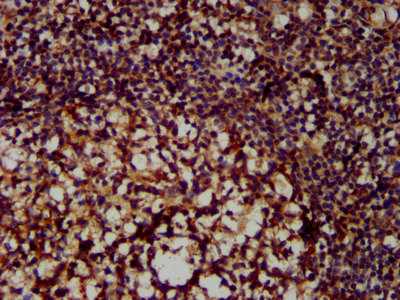 IHC image of CSB-PA015250LA01HU diluted at 1:300 and staining in paraffin-embedded human tonsil tissue performed on a Leica BondTM system. After dewaxing and hydration, antigen retrieval was mediated by high pressure in a citrate buffer (pH 6.0). Section was blocked with 10% normal goat serum 30min at RT. Then primary antibody (1% BSA) was incubated at 4°C overnight. The primary is detected by a biotinylated secondary antibody and visualized using an HRP conjugated SP system. IHC image of CSB-PA015250LA01HU diluted at 1:300 and staining in paraffin-embedded human tonsil tissue performed on a Leica BondTM system. After dewaxing and hydration, antigen retrieval was mediated by high pressure in a citrate buffer (pH 6.0). Section was blocked with 10% normal goat serum 30min at RT. Then primary antibody (1% BSA) was incubated at 4°C overnight. The primary is detected by a biotinylated secondary antibody and visualized using an HRP conjugated SP system.