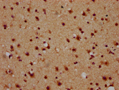IHC image of CSB-PA015445LA01HU diluted at 1:600 and staining in paraffin-embedded human brain tissue performed on a Leica BondTM system. After dewaxing and hydration, antigen retrieval was mediated by high pressure in a citrate buffer (pH 6.0). Section was blocked with 10% normal goat serum 30min at RT. Then primary antibody (1% BSA) was incubated at 4°C overnight. The primary is detected by a biotinylated secondary antibody and visualized using an HRP conjugated SP system. IHC image of CSB-PA015445LA01HU diluted at 1:600 and staining in paraffin-embedded human brain tissue performed on a Leica BondTM system. After dewaxing and hydration, antigen retrieval was mediated by high pressure in a citrate buffer (pH 6.0). Section was blocked with 10% normal goat serum 30min at RT. Then primary antibody (1% BSA) was incubated at 4°C overnight. The primary is detected by a biotinylated secondary antibody and visualized using an HRP conjugated SP system.