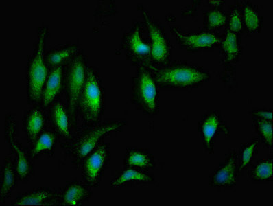 Immunofluorescent analysis of Hela cells using CSB-PA015652ESR1HU at dilution of 1:100 and Alexa Fluor 488-congugated AffiniPure Goat Anti-Rabbit IgG(H+L)