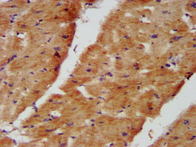 IHC image of CSB-PA015655LA01HU diluted at 1:400 and staining in paraffin-embedded human heart tissue performed on a Leica BondTM system. After dewaxing and hydration, antigen retrieval was mediated by high pressure in a citrate buffer (pH 6.0). Section was blocked with 10% normal goat serum 30min at RT. Then primary antibody (1% BSA) was incubated at 4°C overnight. The primary is detected by a biotinylated secondary antibody and visualized using an HRP conjugated SP system.