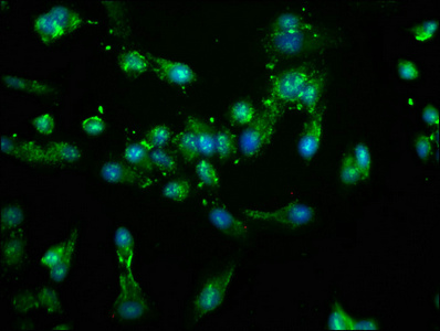 Immunofluorescence staining of Hela cells with CSB-PA015702LA01HU at 1:100, counter-stained with DAPI. The cells were fixed in 4% formaldehyde, permeabilized using 0.2% Triton X-100 and blocked in 10% normal Goat Serum. The cells were then incubated with the antibody overnight at 4°C. The secondary antibody was Alexa Fluor 488-congugated AffiniPure Goat Anti-Rabbit IgG(H+L). Immunofluorescence staining of Hela cells with CSB-PA015702LA01HU at 1:100, counter-stained with DAPI. The cells were fixed in 4% formaldehyde, permeabilized using 0.2% Triton X-100 and blocked in 10% normal Goat Serum. The cells were then incubated with the antibody overnight at 4°C. The secondary antibody was Alexa Fluor 488-congugated AffiniPure Goat Anti-Rabbit IgG(H+L).