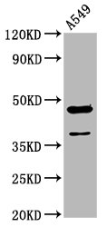 Western Blot Positive WB detected in: A549 whole cell lysate All lanes: NR2F1 antibody at 3.4microg/ml Secondary Goat polyclonal to rabbit IgG at 1/50000 dilution Predicted band size: 47 kDa Observed band size: 47 kDa Western Blot Positive WB detected in: A549 whole cell lysate All lanes: NR2F1 antibody at 3.4microg/ml Secondary Goat polyclonal to rabbit IgG at 1/50000 dilution Predicted band size: 47 kDa Observed band size: 47 kDa
