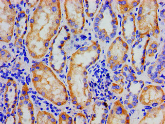 Immunohistochemistry of paraffin-embedded human kidney tissue using CSB-PA016059LA01HU at dilution of 1:100
