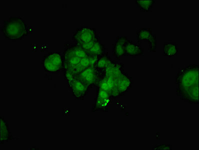 Immunofluorescent analysis of MCF-7 cells using CSB-PA016195LA01HU at dilution of 1:100 and Alexa Fluor 488-congugated AffiniPure Goat Anti-Rabbit IgG(H+L)