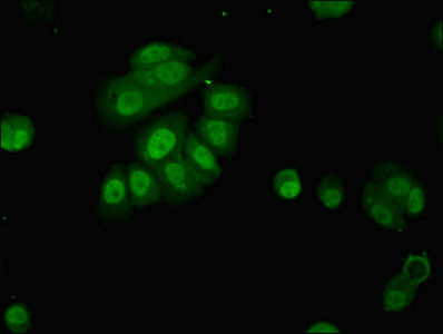 Immunofluorescent analysis of MCF-7 cells using CSB-PA017384LA01HU at dilution of 1:100 and Alexa Fluor 488-congugated AffiniPure Goat Anti-Rabbit IgG(H+L) Immunofluorescent analysis of MCF-7 cells using CSB-PA017384LA01HU at dilution of 1:100 and Alexa Fluor 488-congugated AffiniPure Goat Anti-Rabbit IgG(H+L)