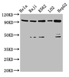 Western Blotting(WB) - PROM1 Antibody