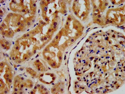IHC image of CSB-PA018838LA01HU diluted at 1:200 and staining in paraffin-embedded human kidney tissue performed on a Leica BondTM system. IHC image of CSB-PA018838LA01HU diluted at 1:200 and staining in paraffin-embedded human kidney tissue performed on a Leica BondTM system.