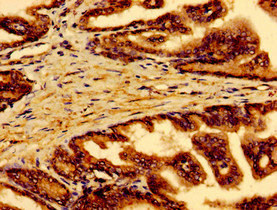 Immunohistochemistry of paraffin-embedded human prostate tissue using CSB-PA019213EA01HU at dilution of 1:100