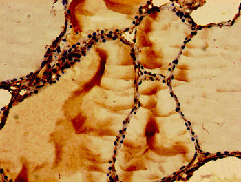 Immunohistochemistry of paraffin-embedded human thyroid tissue using CSB-PA019213EA01HU at dilution of 1:100