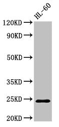 Western Blot Positive WB detected in: HL60 whole cell lysate All lanes: RAB5A antibody at 2.7ug/ml Secondary Goat polyclonal to rabbit IgG at 1/50000 dilution Predicted band size: 24, 23 kDa Observed band size: 24 kDa