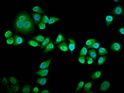 Immunofluorescence staining of Hela cells with CSB-PA019728LA01HU at 1:133, counter-stained with DAPI. The cells were fixed in 4% formaldehyde, permeabilized using 0.2% Triton X-100 and blocked in 10% normal Goat Serum. The cells were then incubated with the antibody overnight at 4°C. The secondary antibody was Alexa Fluor 488-congugated AffiniPure Goat Anti-Rabbit IgG(H+L). Immunofluorescence staining of Hela cells with CSB-PA019728LA01HU at 1:133, counter-stained with DAPI. The cells were fixed in 4% formaldehyde, permeabilized using 0.2% Triton X-100 and blocked in 10% normal Goat Serum. The cells were then incubated with the antibody overnight at 4°C. The secondary antibody was Alexa Fluor 488-congugated AffiniPure Goat Anti-Rabbit IgG(H+L).