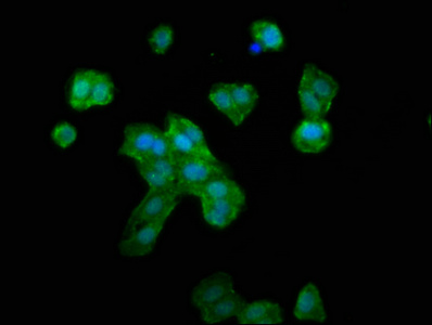 Immunofluorescence staining of HepG2 cells with CSB-PA019888LA01HU at 1:133, counter-stained with DAPI. The cells were fixed in 4% formaldehyde, permeabilized using 0.2% Triton X-100 and blocked in 10% normal Goat Serum. The cells were then incubated with the antibody overnight at 4°C. The secondary antibody was Alexa Fluor 488-congugated AffiniPure Goat Anti-Rabbit IgG(H+L).