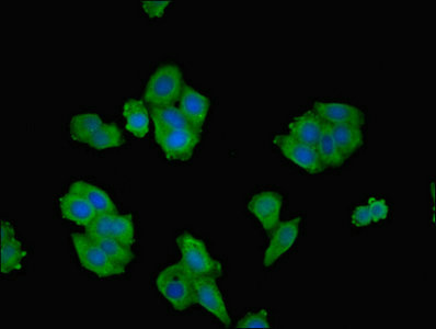 Immunofluorescent analysis of HepG2 cells using CSB-PA020059ESR1HU at dilution of 1:100 and Alexa Fluor 488-congugated AffiniPure Goat Anti-Rabbit IgG(H+L)