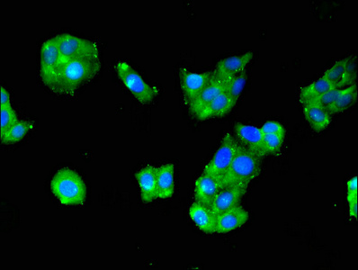 Immunofluorescent analysis of HepG2 cells using CSB-PA020432LA01HU at dilution of 1:100 and Alexa Fluor 488-congugated AffiniPure Goat Anti-Rabbit IgG(H+L) Immunofluorescent analysis of HepG2 cells using CSB-PA020432LA01HU at dilution of 1:100 and Alexa Fluor 488-congugated AffiniPure Goat Anti-Rabbit IgG(H+L)