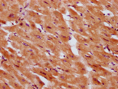 IHC image of CSB-PA021040LA01HU diluted at 1:300 and staining in paraffin-embedded human heart tissue performed on a Leica BondTM system. After dewaxing and hydration, antigen retrieval was mediated by high pressure in a citrate buffer (pH 6.0). Section was blocked with 10% normal goat serum 30min at RT. Then primary antibody (1% BSA) was incubated at 4°C overnight. The primary is detected by a biotinylated secondary antibody and visualized using an HRP conjugated SP system. IHC image of CSB-PA021040LA01HU diluted at 1:300 and staining in paraffin-embedded human heart tissue performed on a Leica BondTM system. After dewaxing and hydration, antigen retrieval was mediated by high pressure in a citrate buffer (pH 6.0). Section was blocked with 10% normal goat serum 30min at RT. Then primary antibody (1% BSA) was incubated at 4°C overnight. The primary is detected by a biotinylated secondary antibody and visualized using an HRP conjugated SP system.