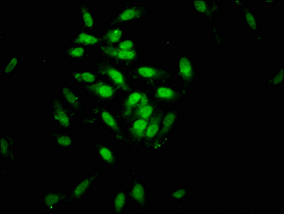 Immunofluorescence staining of Hela cells with CSB-PA021328LA01HU at 1:133, counter-stained with DAPI. The cells were fixed in 4% formaldehyde, permeabilized using 0.2% Triton X-100 and blocked in 10% normal Goat Serum. The cells were then incubated with the antibody overnight at 4°C. The secondary antibody was Alexa Fluor 488-congugated AffiniPure Goat Anti-Rabbit IgG(H+L).