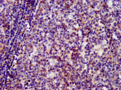 IHC image of CSB-PA021328LA01HU diluted at 1:400 and staining in paraffin-embedded human tonsil tissue performed on a Leica BondTM system. IHC image of CSB-PA021328LA01HU diluted at 1:400 and staining in paraffin-embedded human tonsil tissue performed on a Leica BondTM system.
