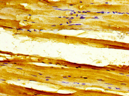 IHC image of CSB-PA021380LA01HU diluted at 1:300 and staining in paraffin-embedded human skeletal muscle tissue performed on a Leica BondTM system. After dewaxing and hydration, antigen retrieval was mediated by high pressure in a citrate buffer (pH 6.0). Section was blocked with 10% normal goat serum 30min at RT. Then primary antibody (1% BSA) was incubated at 4°C overnight. The primary is detected by a biotinylated secondary antibody and visualized using an HRP conjugated SP system.