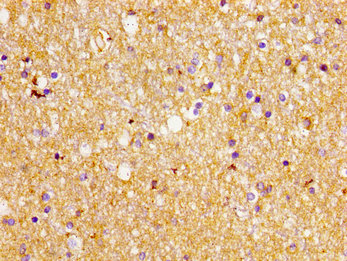 Immunohistochemistry of paraffin-embedded human brain tissue using CSB-PA021433LA01HU at dilution of 1:100