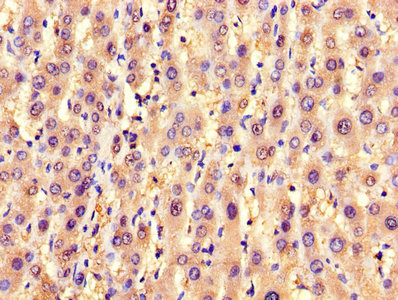 IHC image of CSB-PA021520LA01HU diluted at 1:1200 and staining in paraffin-embedded human liver tissue performed on a Leica BondTM system. After dewaxing and hydration, antigen retrieval was mediated by high pressure in a citrate buffer (pH 6.0). Section was blocked with 10% normal goat serum 30min at RT. Then primary antibody (1% BSA) was incubated at 4°C overnight. The primary is detected by a biotinylated secondary antibody and visualized using an HRP conjugated SP system.
