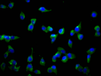 Immunofluorescence staining of SH-SY5Y cells with CSB-PA021741LA01HU at 1:166, counter-stained with DAPI. The cells were fixed in 4% formaldehyde, permeabilized using 0.2% Triton X-100 and blocked in 10% normal Goat Serum. The cells were then incubated with the antibody overnight at 4°C. The secondary antibody was Alexa Fluor 488-congugated AffiniPure Goat Anti-Rabbit IgG(H+L). Immunofluorescence staining of SH-SY5Y cells with CSB-PA021741LA01HU at 1:166, counter-stained with DAPI. The cells were fixed in 4% formaldehyde, permeabilized using 0.2% Triton X-100 and blocked in 10% normal Goat Serum. The cells were then incubated with the antibody overnight at 4°C. The secondary antibody was Alexa Fluor 488-congugated AffiniPure Goat Anti-Rabbit IgG(H+L).