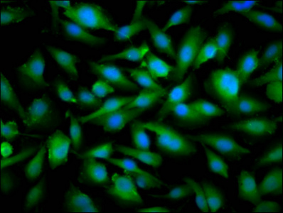 Immunofluorescence staining of U251 cells with CSB-PA022336LA01HU at 1:66, counter-stained with DAPI. The cells were fixed in 4% formaldehyde, permeabilized using 0.2% Triton X-100 and blocked in 10% normal Goat Serum. The cells were then incubated with the antibody overnight at 4°C. The secondary antibody was Alexa Fluor 488-congugated AffiniPure Goat Anti-Rabbit IgG(H+L).