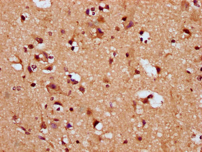 IHC image of CSB-PA022336LA01HU diluted at 1:200 and staining in paraffin-embedded human brain tissue performed on a Leica BondTM system. After dewaxing and hydration, antigen retrieval was mediated by high pressure in a citrate buffer (pH 6.0). Section was blocked with 10% normal goat serum 30min at RT. Then primary antibody (1% BSA) was incubated at 4°C overnight. The primary is detected by a biotinylated secondary antibody and visualized using an HRP conjugated SP system.