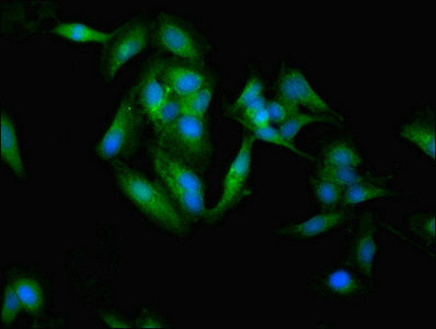Immunofluorescent analysis of Hela cells using CSB-PA022392EA01HU at dilution of 1:100 and Alexa Fluor 488-congugated AffiniPure Goat Anti-Rabbit IgG(H+L)