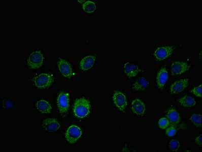 Immunofluorescent analysis of A549 cells using CSB-PA022395ESR1HU at dilution of 1:100 and Alexa Fluor 488-congugated AffiniPure Goat Anti-Rabbit IgG(H+L)