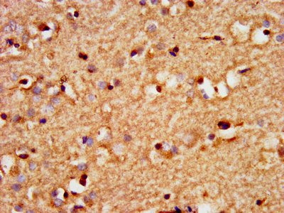 IHC image of CSB-PA022429LA01HU diluted at 1:300 and staining in paraffin-embedded human brain tissue performed on a Leica BondTM system. After dewaxing and hydration, antigen retrieval was mediated by high pressure in a citrate buffer (pH 6.0). Section was blocked with 10% normal goat serum 30min at RT. Then primary antibody (1% BSA) was incubated at 4°C overnight. The primary is detected by a biotinylated secondary antibody and visualized using an HRP conjugated SP system.
