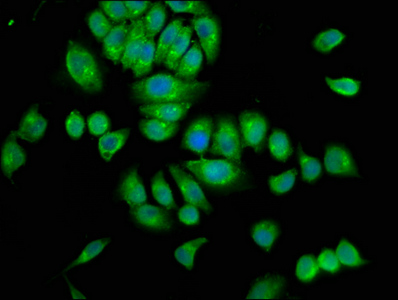 Immunofluorescence staining of A549 cells with CSB-PA022663LA01HU at 1:100, counter-stained with DAPI. The cells were fixed in 4% formaldehyde, permeabilized using 0.2% Triton X-100 and blocked in 10% normal Goat Serum. The cells were then incubated with the antibody overnight at 4°C. The secondary antibody was Alexa Fluor 488-congugated AffiniPure Goat Anti-Rabbit IgG(H+L). Immunofluorescence staining of A549 cells with CSB-PA022663LA01HU at 1:100, counter-stained with DAPI. The cells were fixed in 4% formaldehyde, permeabilized using 0.2% Triton X-100 and blocked in 10% normal Goat Serum. The cells were then incubated with the antibody overnight at 4°C. The secondary antibody was Alexa Fluor 488-congugated AffiniPure Goat Anti-Rabbit IgG(H+L).
