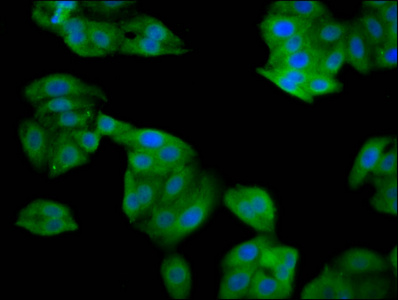 Immunofluorescence staining of HepG2 cells with CSB-PA022673LA01HU at 1:133, counter-stained with DAPI. The cells were fixed in 4% formaldehyde, permeabilized using 0.2% Triton X-100 and blocked in 10% normal Goat Serum. The cells were then incubated with the antibody overnight at 4°C. The secondary antibody was Alexa Fluor 488-congugated AffiniPure Goat Anti-Rabbit IgG(H+L). Immunofluorescence staining of HepG2 cells with CSB-PA022673LA01HU at 1:133, counter-stained with DAPI. The cells were fixed in 4% formaldehyde, permeabilized using 0.2% Triton X-100 and blocked in 10% normal Goat Serum. The cells were then incubated with the antibody overnight at 4°C. The secondary antibody was Alexa Fluor 488-congugated AffiniPure Goat Anti-Rabbit IgG(H+L).