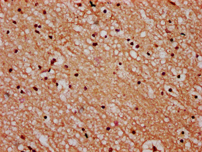 IHC image of CSB-PA022827LA01HU diluted at 1:600 and staining in paraffin-embedded human brain tissue performed on a Leica BondTM system. After dewaxing and hydration, antigen retrieval was mediated by high pressure in a citrate buffer (pH 6.0). Section was blocked with 10% normal goat serum 30min at RT. Then primary antibody (1% BSA) was incubated at 4°C overnight. The primary is detected by a biotinylated secondary antibody and visualized using an HRP conjugated SP system.