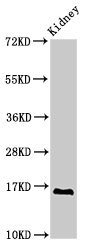 Western Blot Positive WB detected in: Rat kidney tissue All lanes: SYNJ2BP antibody at 2.8microg/ml Secondary Goat polyclonal to rabbit IgG at 1/50000 dilution Predicted band size: 16 kDa Observed band size: 16 kDa