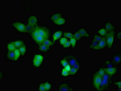 Immunofluorescent analysis of PC-3 cells using CSB-PA023181EA01HU at dilution of 1:100 and Alexa Fluor 488-congugated AffiniPure Goat Anti-Rabbit IgG(H+L)