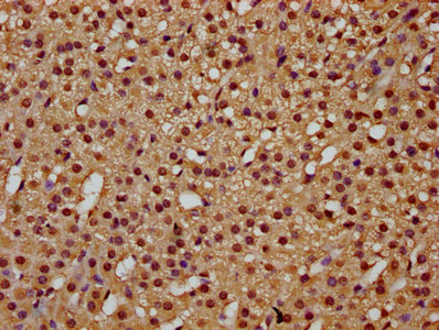 IHC image of CSB-PA023291LA01HU diluted at 1:300 and staining in paraffin-embedded human adrenal gland tissue performed on a Leica BondTM system. After dewaxing and hydration, antigen retrieval was mediated by high pressure in a citrate buffer (pH 6.0). Section was blocked with 10% normal goat serum 30min at RT. Then primary antibody (1% BSA) was incubated at 4°C overnight. The primary is detected by a biotinylated secondary antibody and visualized using an HRP conjugated SP system.