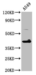 Western Blot Positive WB detected in: A549 whole cell lysate All lanes: TFB1M antibody at 4.6microg/ml Secondary Goat polyclonal to rabbit IgG at 1/50000 dilution Predicted band size: 40 kDa Observed band size: 40 kDa Western Blot Positive WB detected in: A549 whole cell lysate All lanes: TFB1M antibody at 4.6microg/ml Secondary Goat polyclonal to rabbit IgG at 1/50000 dilution Predicted band size: 40 kDa Observed band size: 40 kDa